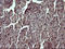 Tumor Protein P73 antibody, LS-C788199, Lifespan Biosciences, Immunohistochemistry paraffin image 