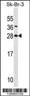 Syndecan 4 antibody, 58-770, ProSci, Western Blot image 
