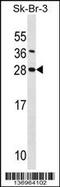 SDC4 antibody, 58-770, ProSci, Western Blot image 