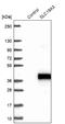 Solute Carrier Family 19 Member 3 antibody, NBP1-86943, Novus Biologicals, Western Blot image 