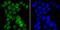 Chromatin Assembly Factor 1 Subunit A antibody, A02732, Boster Biological Technology, Immunocytochemistry image 