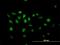 CTF antibody, H00004784-B01P, Novus Biologicals, Immunocytochemistry image 