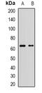MLLT3 Super Elongation Complex Subunit antibody, orb341183, Biorbyt, Western Blot image 