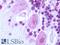 Galanin Receptor 2 antibody, LS-A4155, Lifespan Biosciences, Immunohistochemistry paraffin image 