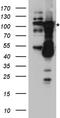DNA (cytosine-5)-methyltransferase 3B antibody, TA890112S, Origene, Western Blot image 