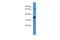 SH3 Domain Binding Protein 5 antibody, A07446, Boster Biological Technology, Western Blot image 