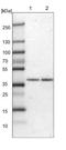 Zinc Finger DHHC-Type Containing 20 antibody, NBP1-82046, Novus Biologicals, Western Blot image 