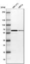 Beta-1,4-N-Acetyl-Galactosaminyltransferase 1 antibody, NBP1-88662, Novus Biologicals, Western Blot image 