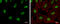 RecQ Like Helicase antibody, GTX100084, GeneTex, Immunocytochemistry image 