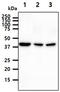 Protein Phosphatase Methylesterase 1 antibody, GTX57695, GeneTex, Western Blot image 