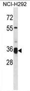Transmembrane Serine Protease 12 antibody, AP54299PU-N, Origene, Western Blot image 