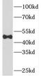 Sorting Nexin 5 antibody, FNab08094, FineTest, Western Blot image 