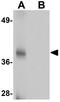 Transmembrane Protein 38A antibody, GTX85221, GeneTex, Western Blot image 