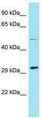 HENMT1 antibody, TA337343, Origene, Western Blot image 