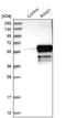 Ring Finger Protein 1 antibody, NBP1-80830, Novus Biologicals, Western Blot image 