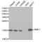 NME/NM23 Nucleoside Diphosphate Kinase 1 antibody, abx125033, Abbexa, Western Blot image 