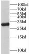 Voltage Dependent Anion Channel 1 antibody, FNab09384, FineTest, Western Blot image 