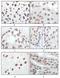 Cyclin Dependent Kinase Inhibitor 2A antibody, A00016-3, Boster Biological Technology, Immunohistochemistry paraffin image 