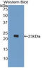 PK3CB antibody, LS-C299663, Lifespan Biosciences, Western Blot image 