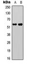 Caspase 8 antibody, LS-C368586, Lifespan Biosciences, Western Blot image 