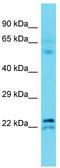 Transmembrane Protein 182 antibody, TA333513, Origene, Western Blot image 