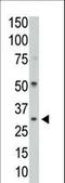 Serine/threonine-protein phosphatase PP1-gamma catalytic subunit antibody, LS-C101010, Lifespan Biosciences, Western Blot image 