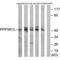 Putative serine/threonine-protein phosphatase 4 regulatory subunit 1-like antibody, A18497, Boster Biological Technology, Western Blot image 
