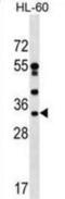 DnaJ Heat Shock Protein Family (Hsp40) Member C17 antibody, abx029905, Abbexa, Western Blot image 