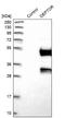 DEP Domain Containing MTOR Interacting Protein antibody, NBP1-85257, Novus Biologicals, Western Blot image 