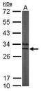 Potassium Voltage-Gated Channel Interacting Protein 3 antibody, GTX105901, GeneTex, Western Blot image 