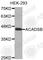 Acyl-CoA Dehydrogenase Short/Branched Chain antibody, A3715, ABclonal Technology, Western Blot image 