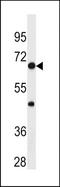 p65 antibody, TA324641, Origene, Western Blot image 