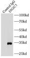 Endoplasmic Reticulum-Golgi Intermediate Compartment 1 antibody, FNab02839, FineTest, Immunoprecipitation image 
