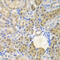 Aldo-Keto Reductase Family 1 Member A1 antibody, 15-081, ProSci, Immunohistochemistry paraffin image 