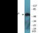 Checkpoint Kinase 1 antibody, EKC2372, Boster Biological Technology, Western Blot image 