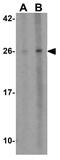 Bcl-2-like protein 10 antibody, GTX31677, GeneTex, Western Blot image 