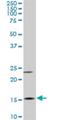 Myosin Light Chain 6 antibody, H00004637-M03, Novus Biologicals, Western Blot image 