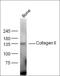 Collagen Type II Alpha 1 Chain antibody, orb182930, Biorbyt, Western Blot image 