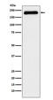 ATPase Family AAA Domain Containing 2 antibody, M03855, Boster Biological Technology, Western Blot image 