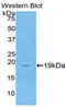 Colony Stimulating Factor 3 antibody, LS-C293456, Lifespan Biosciences, Western Blot image 