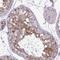 Ubiquitin Conjugating Enzyme E2 S antibody, NBP2-38822, Novus Biologicals, Immunohistochemistry frozen image 