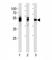 LCK Proto-Oncogene, Src Family Tyrosine Kinase antibody, F53783-0.1ML, NSJ Bioreagents, Western Blot image 