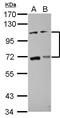 ADAM Metallopeptidase With Thrombospondin Type 1 Motif 5 antibody, GTX100332, GeneTex, Western Blot image 