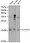 Cyclin-dependent kinase 4 inhibitor B antibody, 13-165, ProSci, Western Blot image 