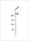 Leucine Rich Repeat Kinase 2 antibody, F53185-0.4ML, NSJ Bioreagents, Western Blot image 