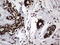 Heterogeneous Nuclear Ribonucleoprotein L antibody, LS-C798241, Lifespan Biosciences, Immunohistochemistry paraffin image 