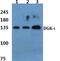 Diacylglycerol Kinase Iota antibody, PA5-75219, Invitrogen Antibodies, Western Blot image 