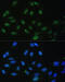 DExD-Box Helicase 50 antibody, 23-692, ProSci, Immunofluorescence image 