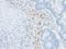 CD209 Molecule antibody, M01025, Boster Biological Technology, Immunohistochemistry paraffin image 