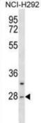 Chymotrypsin Like antibody, abx030479, Abbexa, Western Blot image 